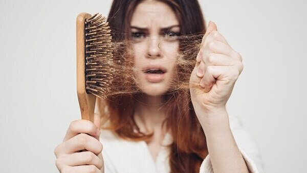 FAQs about alopecia treatment