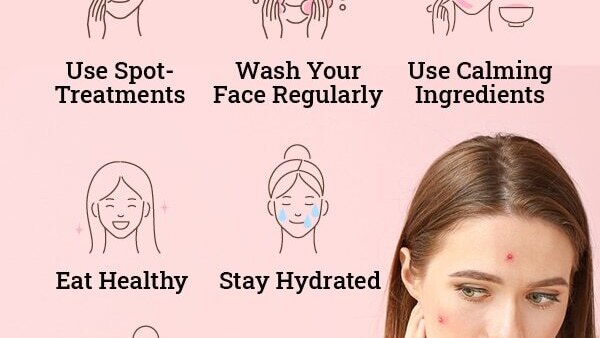 FAQs about cold sore vs. pimples