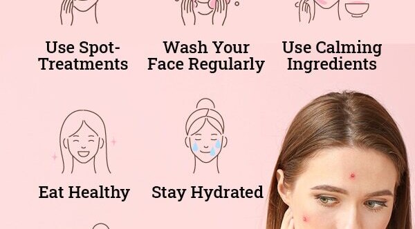 FAQs about cold sore vs. pimples