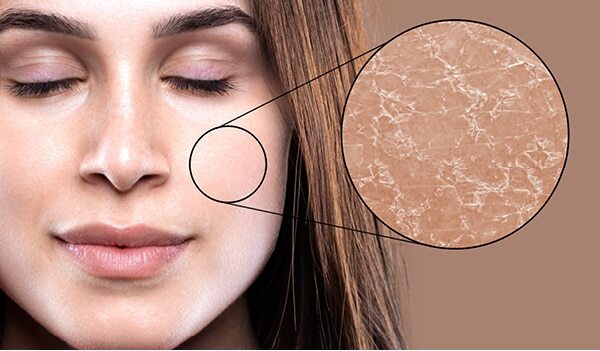 Treat Dehydrated Skin To Reveal The Flawless Skin Beneath