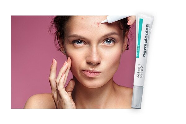 5 products that will help tackle forehead pimples like no other
