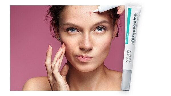 5 products that will help tackle forehead pimples like no other