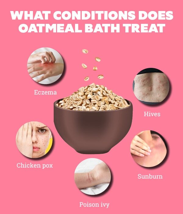 FAQs about oatmeal bath