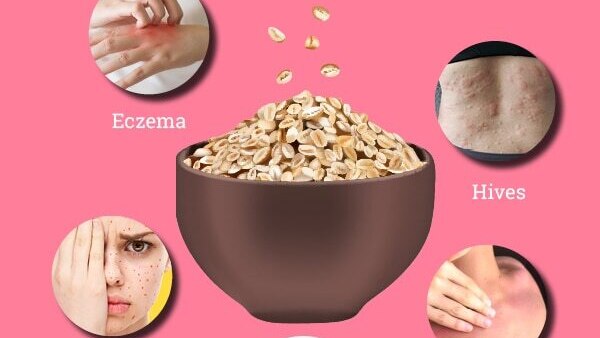 FAQs about oatmeal bath