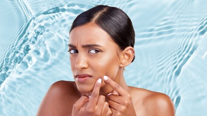 FAQs about Glycolic Acid in Skincare Routine