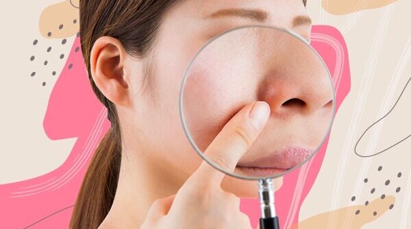 How to Deal With Redness Around The Nose