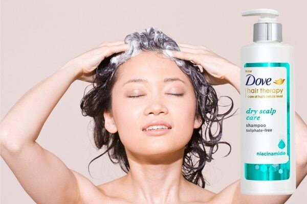 dry-scalp-in-winter