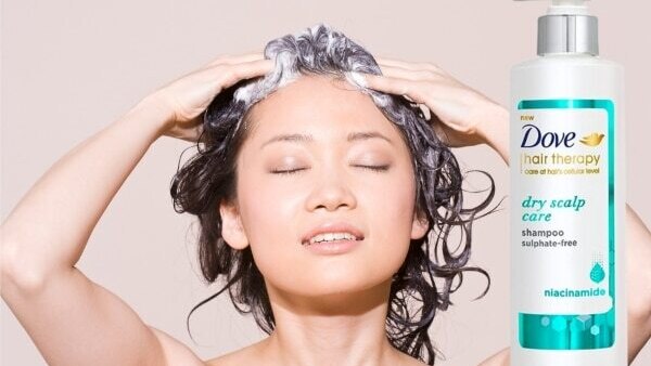 dry-scalp-in-winter