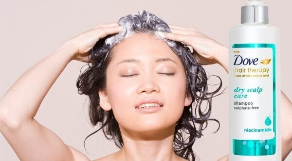 dry-scalp-in-winter