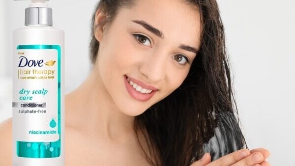 dry-scalp-in-winter