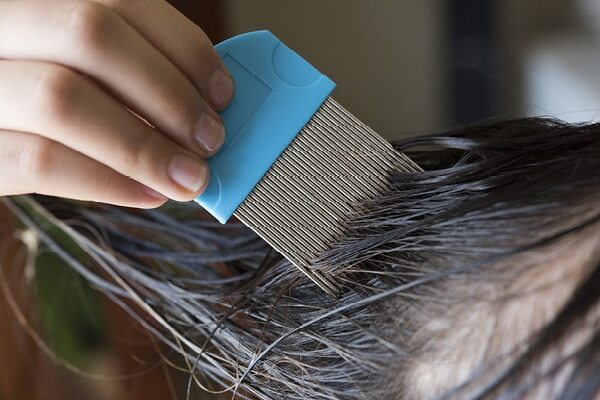 FAQs about Lice Removal Battle
