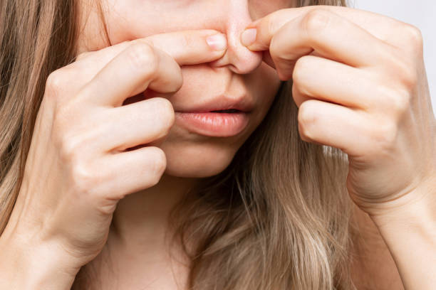 Blackhead Removal Success Stories: Your Best Method Revealed