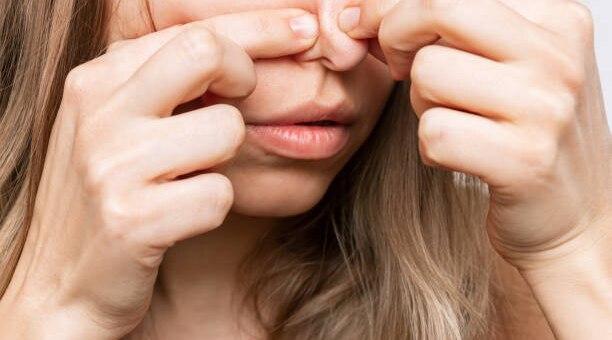 Blackhead Removal Success Stories: Your Best Method Revealed