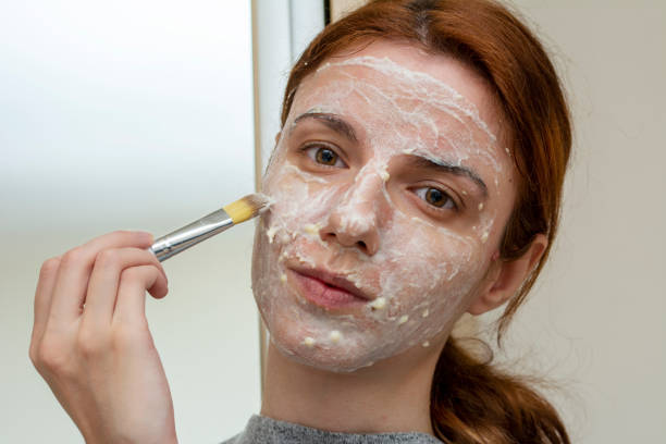 blackhead-removal