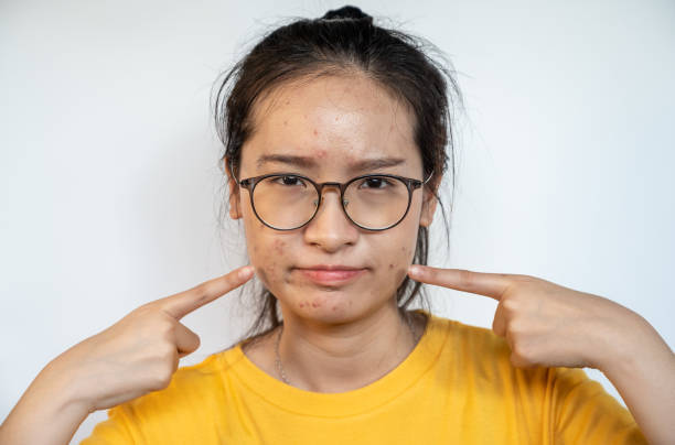 Ultimate Skincare Routine For Oily Skin: Your Guide