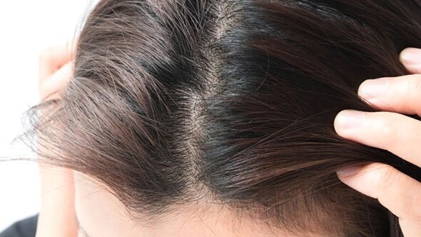 3. You shed more hair