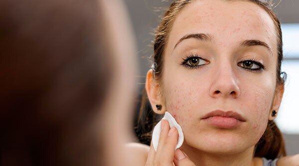 8 Tips To Heal Skin Inflammation