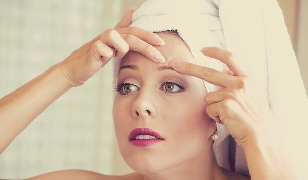 How To Battle Blackheads with Natural Remedies