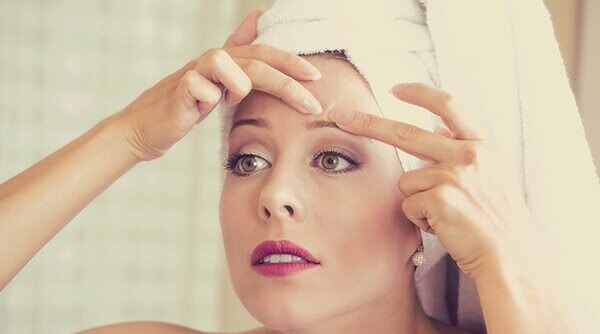 How To Battle Blackheads with Natural Remedies