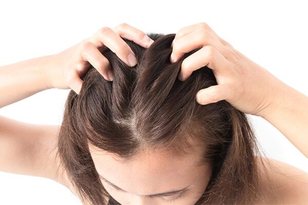 Disease-related dandruff
