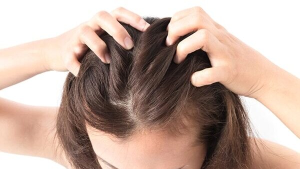 Disease-related dandruff