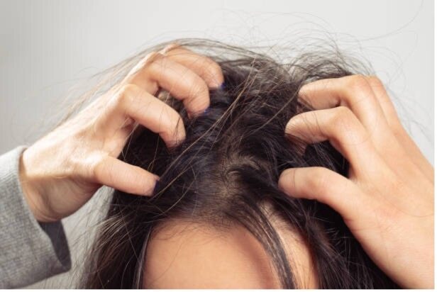 5. Helps with Itchiness and Irritation