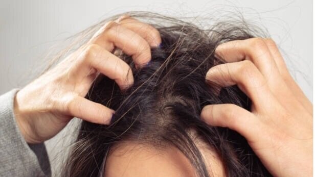 5. Helps with Itchiness and Irritation