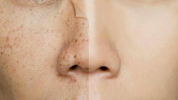 FAQs about guava benefits for skin
