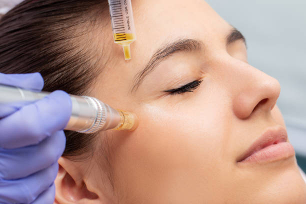 Serums To Use For Microneedling: 3 Of The Best
