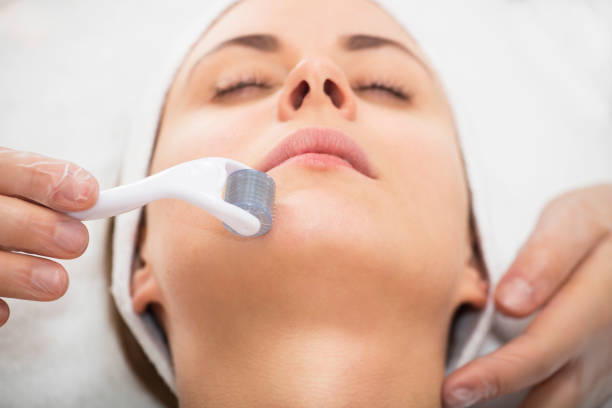 hyaluronic acid serum after microneedling faq