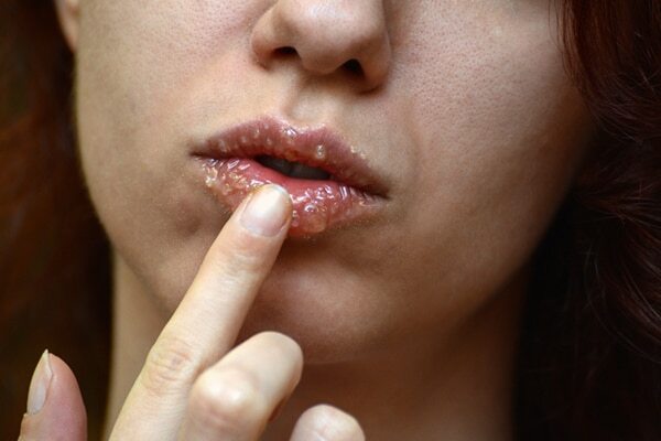 Turmeric lip mask