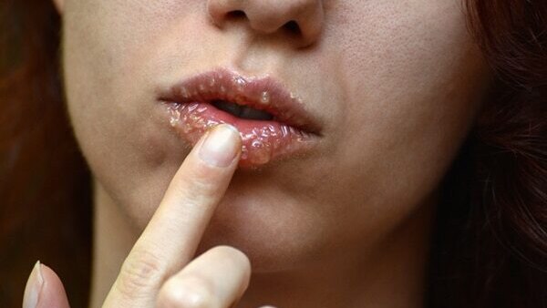 Turmeric lip mask