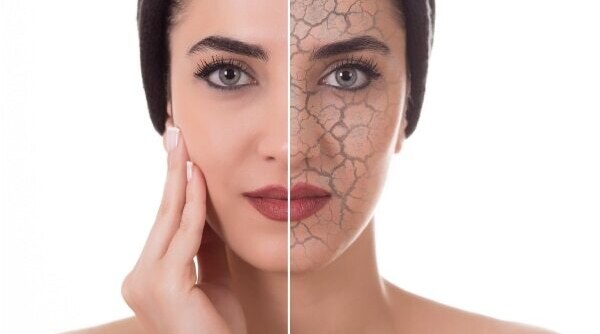 Say Goodbye To Dryness With These Hydrating Face Washes