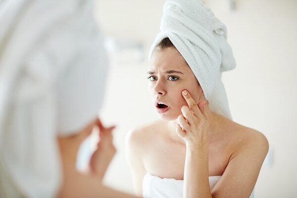 Your skin might breakout