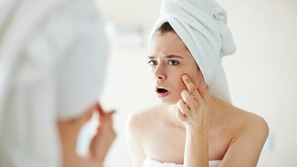 Your skin might breakout