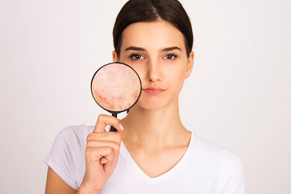 #5: Pick water-based sunscreens if you have oily, acne-prone skin