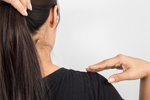 FAQs about fenugreek for hair