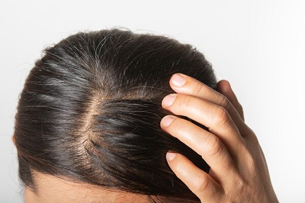 FAQs about fenugreek for hair