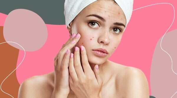 Benzoyl Peroxide V/S Salicylic Acid: What Works Best To Treat Acne