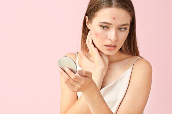 FAQs about benzoyl peroxide and salicylic acid