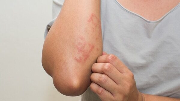 Exfoliate regularly… after a few days