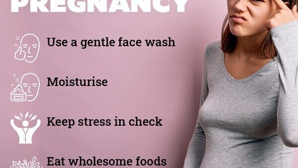 FAQs about pregnancy acne