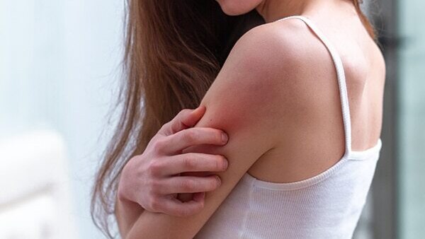 Fights pigmentation