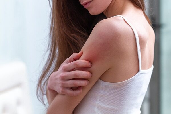 Fights pigmentation
