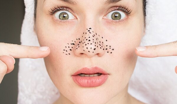 Say Goodbye To Blackheads With These 9 Homemade Face Scrubs