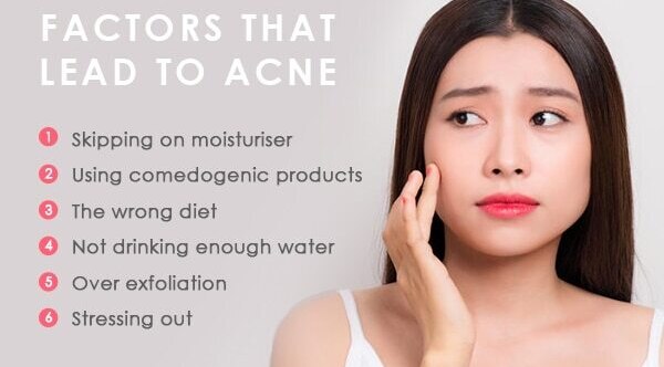 Frequently asked questions about face packs for oily skin
