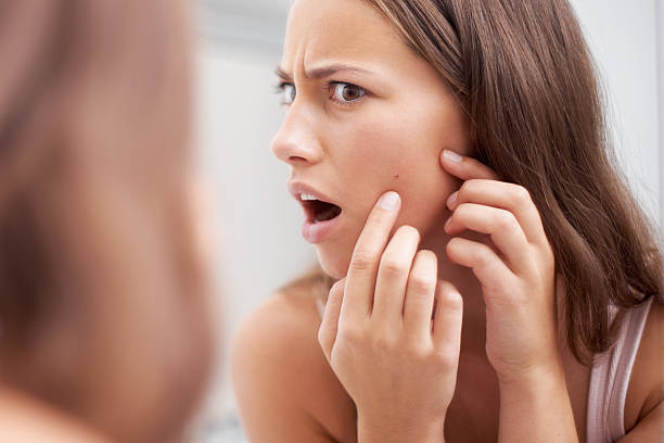 AHA vs BHA: What are the benefits of this blended mix | Everything to Know