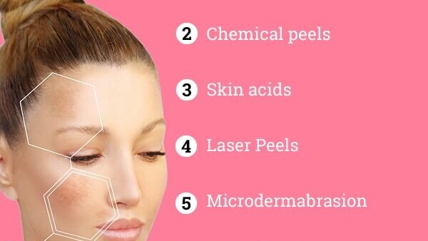 FAQs about hyperpigmentation treatment