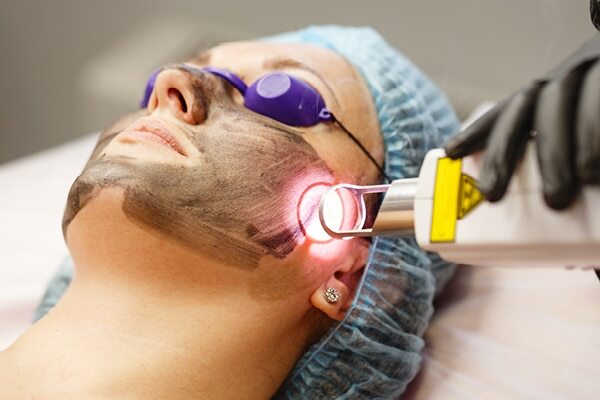 FAQs about hyperpigmentation treatment