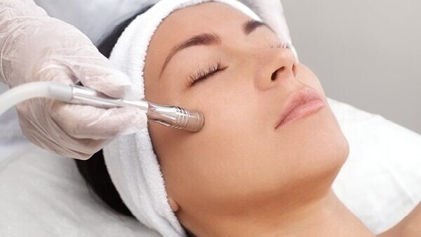 FAQs about hyperpigmentation treatment